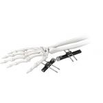 Orthopedic Wrist External Fixator Standard Single sided Integrated for sale