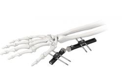 China Orthopedic Wrist External Fixator Standard Single sided Integrated supplier