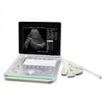 Portable ultrasound machine Laptop Ultrasound machine SU-7S with CE for sale