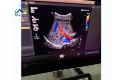 China  EPIQ 7 Report Error 227 Ultrasound Machine Repair Replace ACB Board supplier