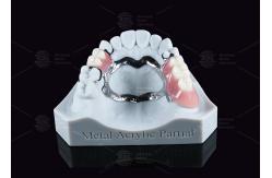China Removable Metal Acrylic Partial Denture With Clasps For Partial Chewing supplier