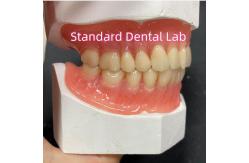 China Full Upper And Lower Stayplate Acrylic Partial Dentures Ivoclar Teeth Pink Gum supplier