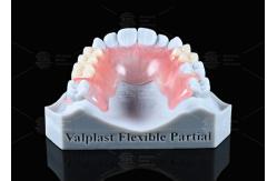 China Natural Looking Valplast Partial Denture Longevity Highly Resistant To Fractures supplier