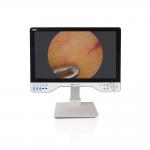 24 Inch Laparoscopic Monitor 4K UHD Endoscope Camera System Surgical LED With Light Source for sale