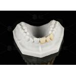 Durable Hypoallergenic EMAX Bridge Extreme Esthetics Emax Dental Bridge