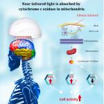 Treat Ischemic Stroke Health Analyzer Machine Blood Photobiomodulation Therapy Helmet for sale