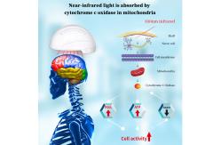 China 810 Nm Health Analyzer Machine Transcranial Magnetic Stimulation Neurofeedback Devices supplier