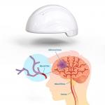 Transcranial Magnetic Stimulation Neurofeedback Devices 810nm Infrared Stroke