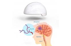 China Transcranial Magnetic Stimulation Neurofeedback Devices 810nm Infrared Stroke supplier