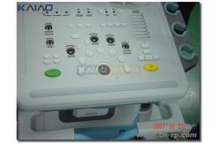 China ABS CNC Rapid Prototyping For Medical Device Automotive Home Appliances supplier