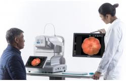 China Double Dots Auxiliary Automatic Fundus Camera 60 Lp / Mm Digital Retinal Imaging supplier