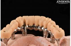 China Yellow Resin Temporary Teeth Smooth Surface Treatment Precise And Stable supplier