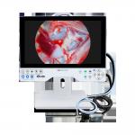 15.6 Inch Rigid All in One Endoscope Camera System 1080P Medical Grade with Local Playback Function for sale