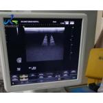 Aloka Hivision Ascendus Report Error Ultrasound Machine Repair Replace Cell Board for sale