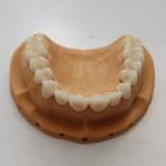 SHT Complete Zirconia System , Blocks + Staining Liquids + Protocols for sale