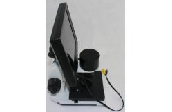 China Magnification 400 Times Digital Microcirculation Microscope Nailfold Microcirculation Equipment supplier