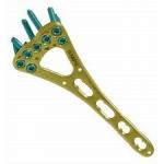 Shoulder Hook  Collarbone  Distal Accumed Clavicle Fracture Plate Fixation for sale