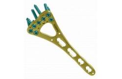 China Shoulder Hook  Collarbone  Distal Accumed Clavicle Fracture Plate Fixation supplier