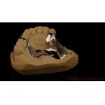 High Strength 3D Printed Cast Framework COCR Partial Dentures Chrome Cobalt Cast Metal Framework for sale