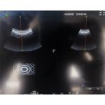 GE RAB6-D 4D Ultrasound Transducer Repair Cardiovascular Ultrasound Machine for sale