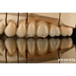White Full Zirconia With High Resistance To Thermal Shock High Strength for sale