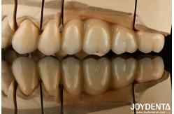 China White Full Zirconia With High Resistance To Thermal Shock High Strength supplier