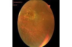 China Autoexposure Automated Fundus Camera FFA Non Mydriatic supplier