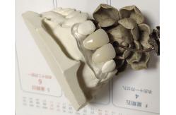 China Soft Elastic Nylon Trushine Invisible Denture supplier