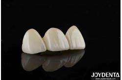 China Natural-looking Style With Layers Full Zirconia High Translucency And Aesthetics supplier