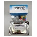Ce Approved Elisa Test Kit One Step Medical Diagnostic Device For Hbcab Igm for sale