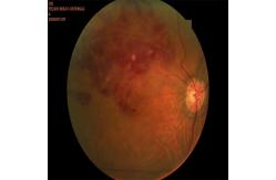 China Autofocus Ultra Wide Field Fundus Camera 3.3mm Non Contact supplier