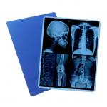 China Industry Leading Production Our Professionally Produced Medical Blue X - Ray Film For Laser Printing Is The Go - To Choice. manufacturer