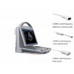 Portable Pregnancy Ultrasound Scanner with Abdominal Convex Transvaginal Transducers for sale