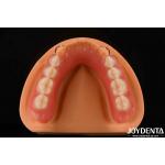 Personalized Customization Acrylic Denture Finish Lightweight High Elasticity for sale