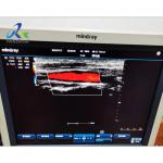 Abnormal Image Ultrasound Machine Repair Service Mindray DC-3
