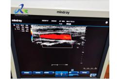 China Abnormal Image Ultrasound Machine Repair Service Mindray DC-3 supplier
