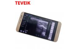 China USB Ultrasound Transducer Probe Convex for IOS, Android and Windows supplier