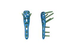 China Orthopedic Small Fragment  Trauma Locking Plate Screw supplier