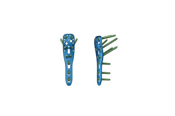 Orthopedic Small Fragment Trauma Locking Plate Screw
