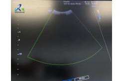 China Ultrasound Probe Transducer Replce Strain Relief Cable And Lense Samsung CA1-7A supplier