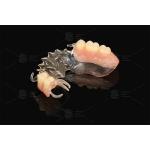 Vertex Clear  Flexible Partial Virtually Unbreakable Low Allergy Risk Full Partial Denture for sale