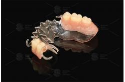 China Vertex Clear  Flexible Partial Virtually Unbreakable Low Allergy Risk Full Partial Denture supplier