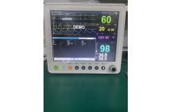 China Portable Veterinary ECG Machine with Battery/AC Power Supply supplier