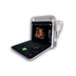4d Ultrasound Machine Portable Ultrasound Scanner With 3D And Phased Array Probe Optional for sale