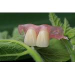 Flexible Invisible Denture for sale