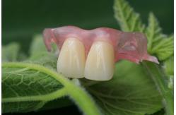 China Flexible Invisible Denture supplier