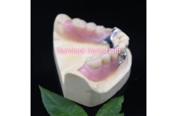 China Acrylic Metal Partial Denture Frameworks High Esthetics SDL dental lab supplier