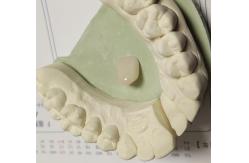China Resin Natural Colour Composite Temporary Crown For Anterior Teeth supplier