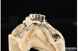 China Alloying Metal Dental Framework Removable Wearable For Dental Practitioners supplier