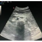 Biosound CA541 Convex Array Probe Vascular Urology Ultrasound Transducer Medical System